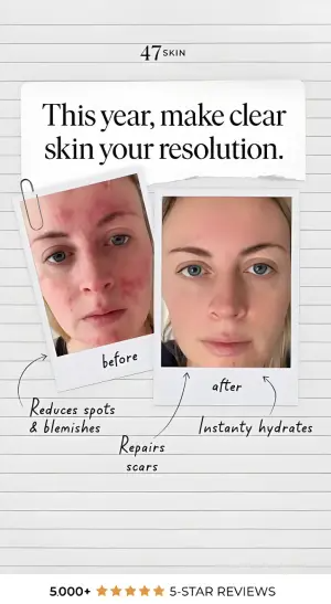 notebook-paper skincare ad with taped before and after Polaroids and handwritten arrows pointing to benefits