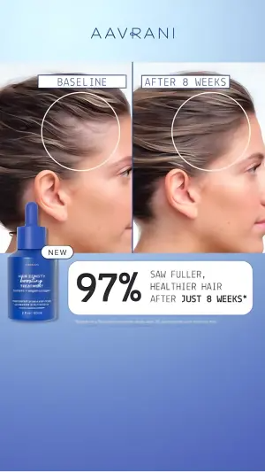 before-after hairline ad with white guide circles, a serum bottle and a 97 percent proof badge