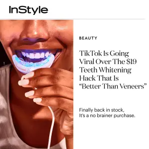 Editorial-style ad with a fashion magazine masthead beside a photo of a glowing LED teeth whitening device