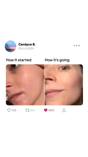 fake social post ad showing a How it started and How it's going skin comparison with likes and reposts