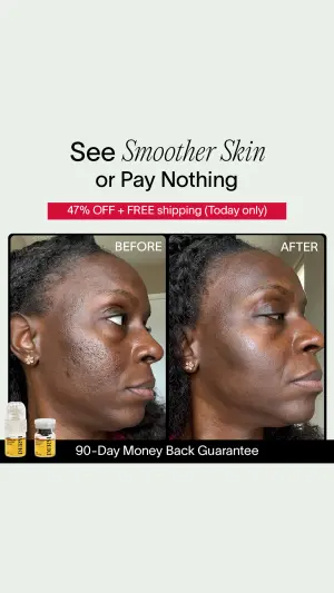 before-after facial profile ad with a red discount banner and a 90-day money back guarantee bar