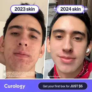 split-screen ad showing a young man with acne labelled 2023 skin and clear skin labelled 2024 skin above a purple brand banner