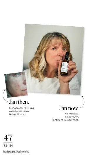scrapbook-style skincare ad with taped photos labelled Jan then and Jan now with handwritten style captions